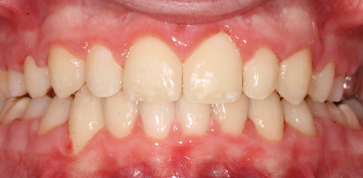 orthodontic-after-01