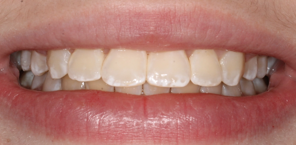 orthodontic-after-03