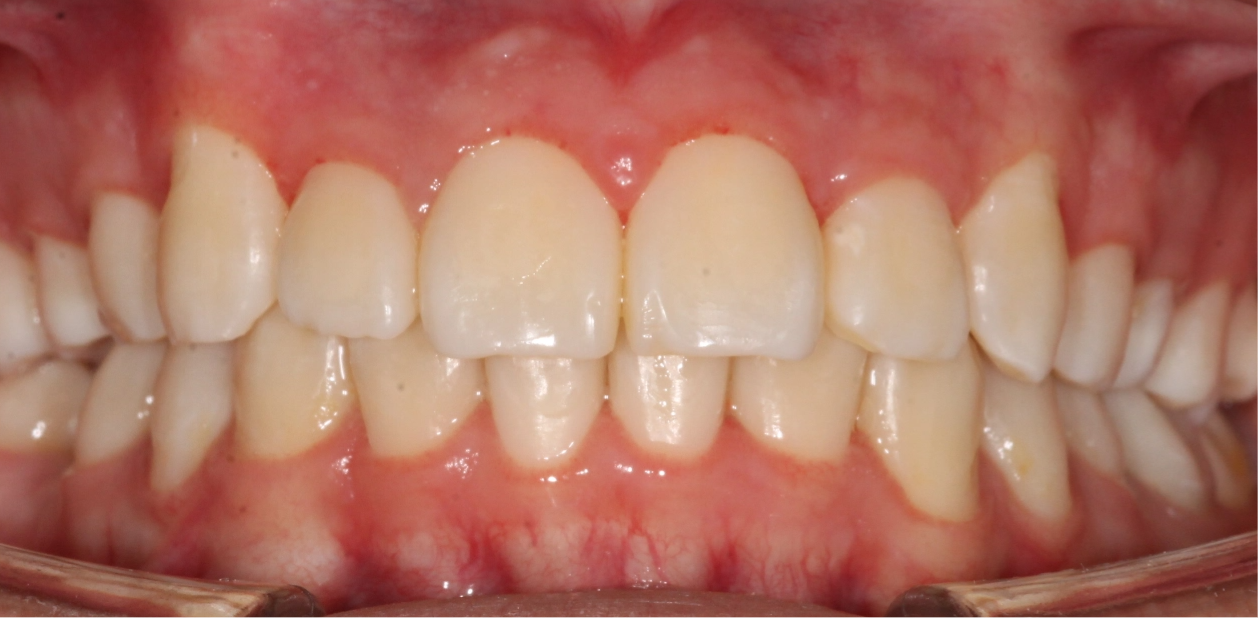 orthodontic-after-04