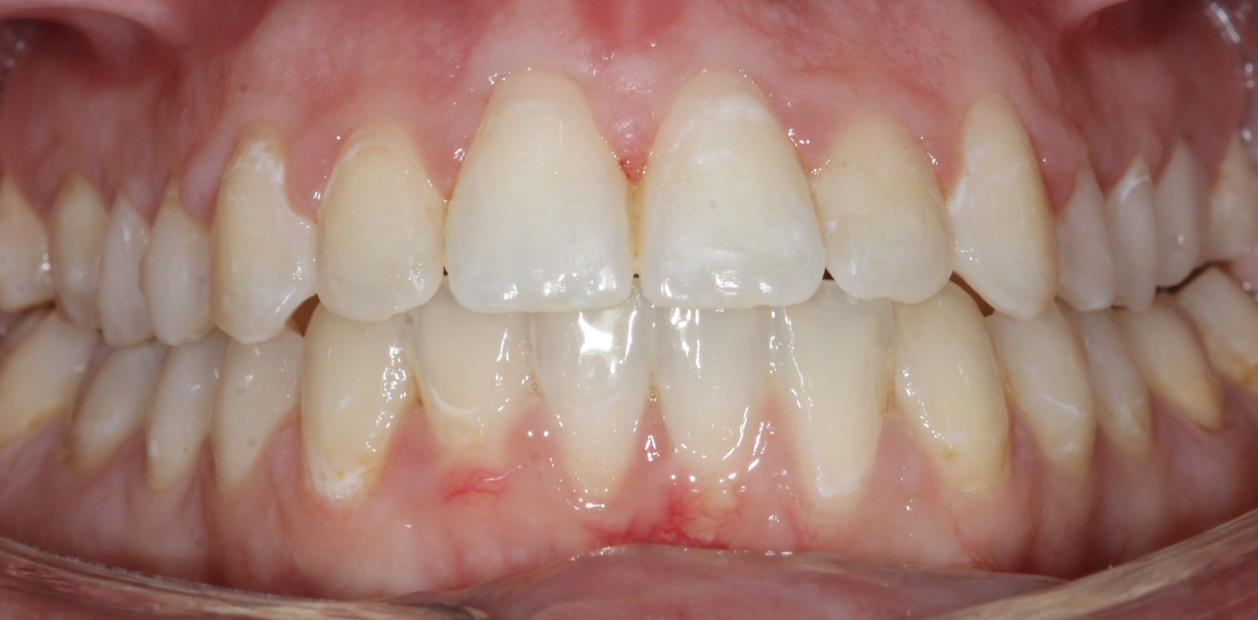 orthodontic-after-05