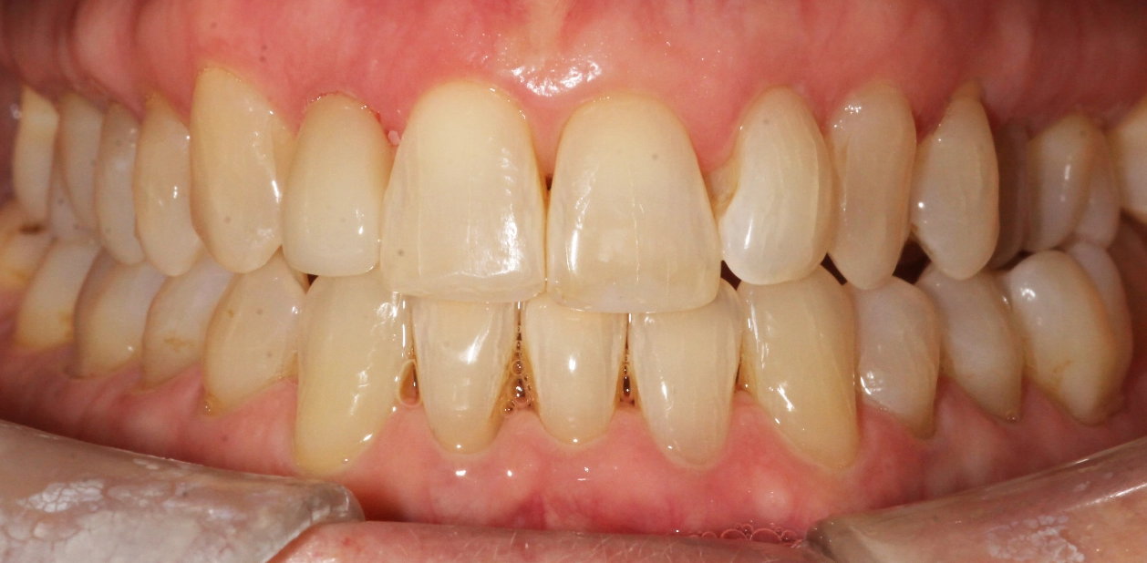 orthodontic-after-06